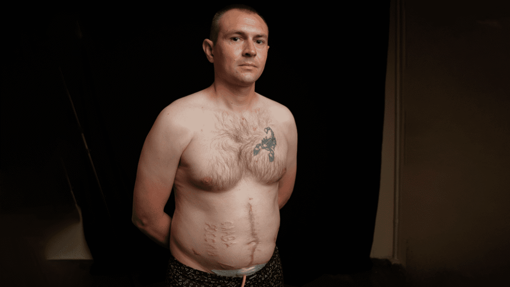 სამხედრო ტყვეების მიმართ არაადამიანური მოპყრობის მტკიცებულებები